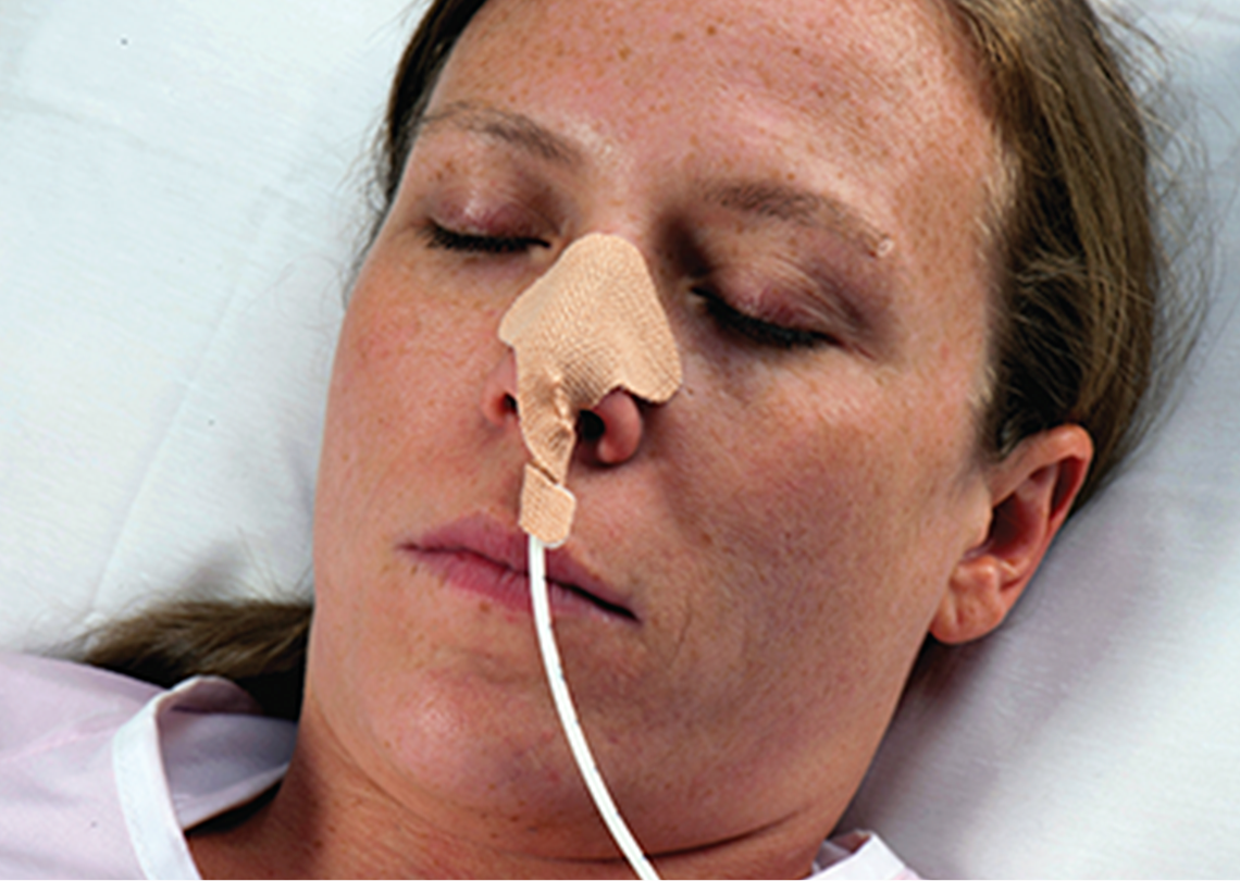 sujetador sonda nasogastrica