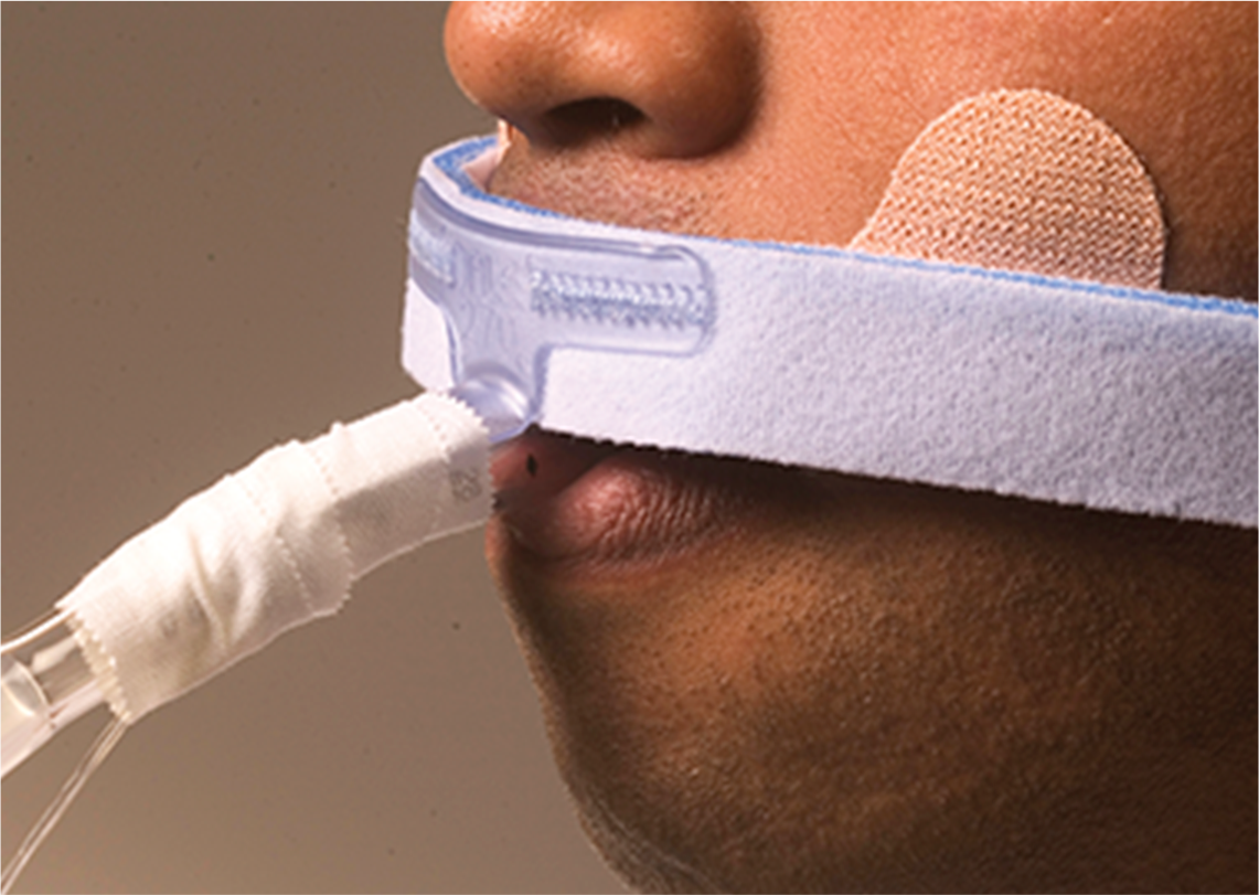 sujetador tubo endotraqueal